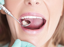 Closeup of woman receiving dental exam