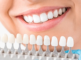 Closeup of smile with tooth shade chart in front of it