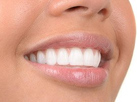Closeup of smile with straight white teeth