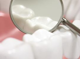 Closeup of animated tooth with natural looking filling