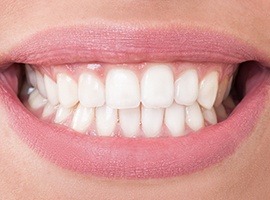 Closeup of smile with flawless teeth after treatment from Brick dental office