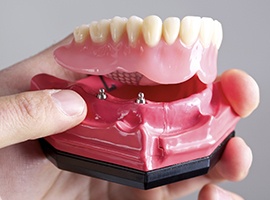 Hand holding a model of an implant denture in Brick